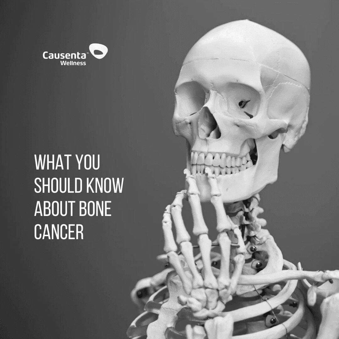 Aching Bones? Don't Be Afraid To Ask Your Doctor To Rule Out Bone Cancer if Pain Persists!