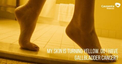 My skin is turning yellow. Do I have gallbladder cancer?