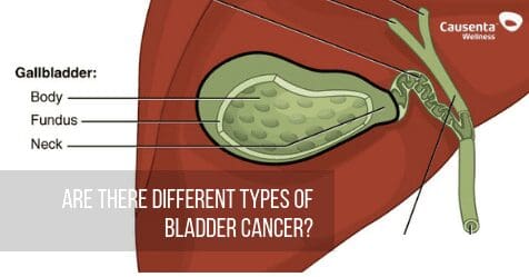 Are there different types of bladder cancer?