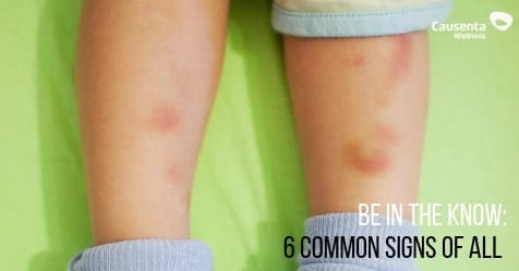 Be in the Know: 6 Common Signs of ALL