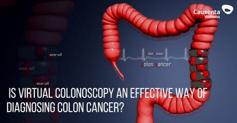 Is virtual colonoscopy, using a CT scan, an effective way of diagnosing colon cancer? And, should everyone get screened?