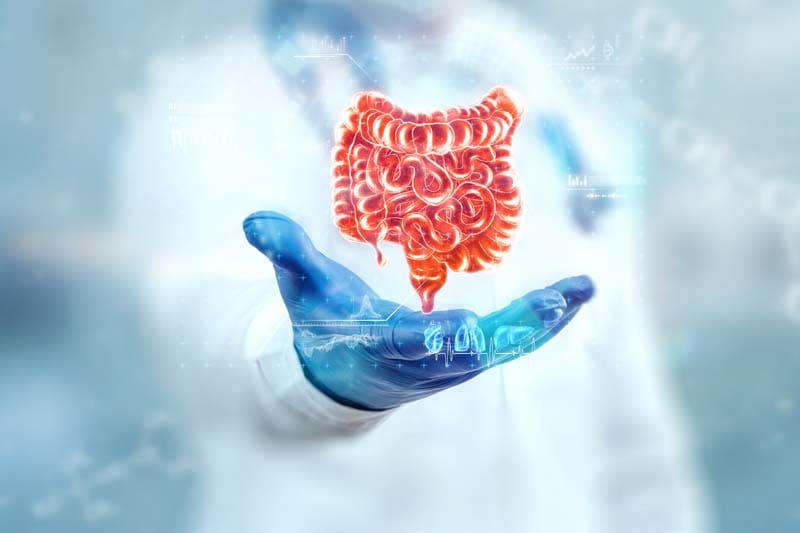 Colon Cancer