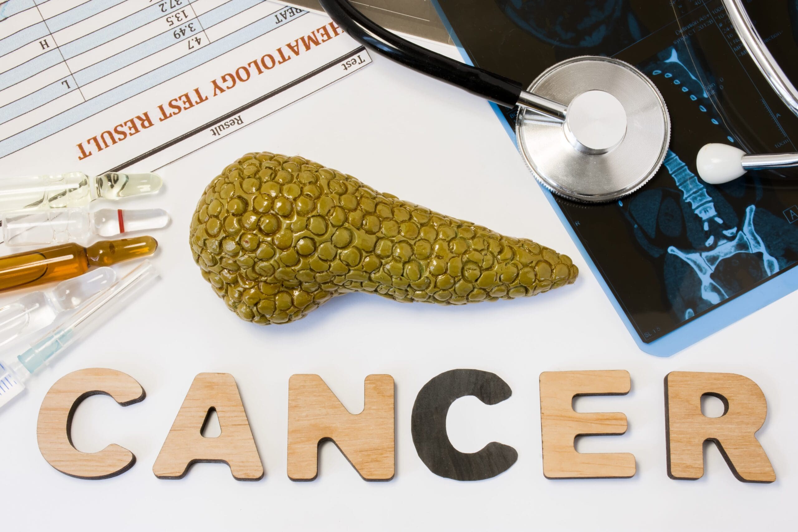 How To Manage Your Diet When You Have Pancreatic Cancer
