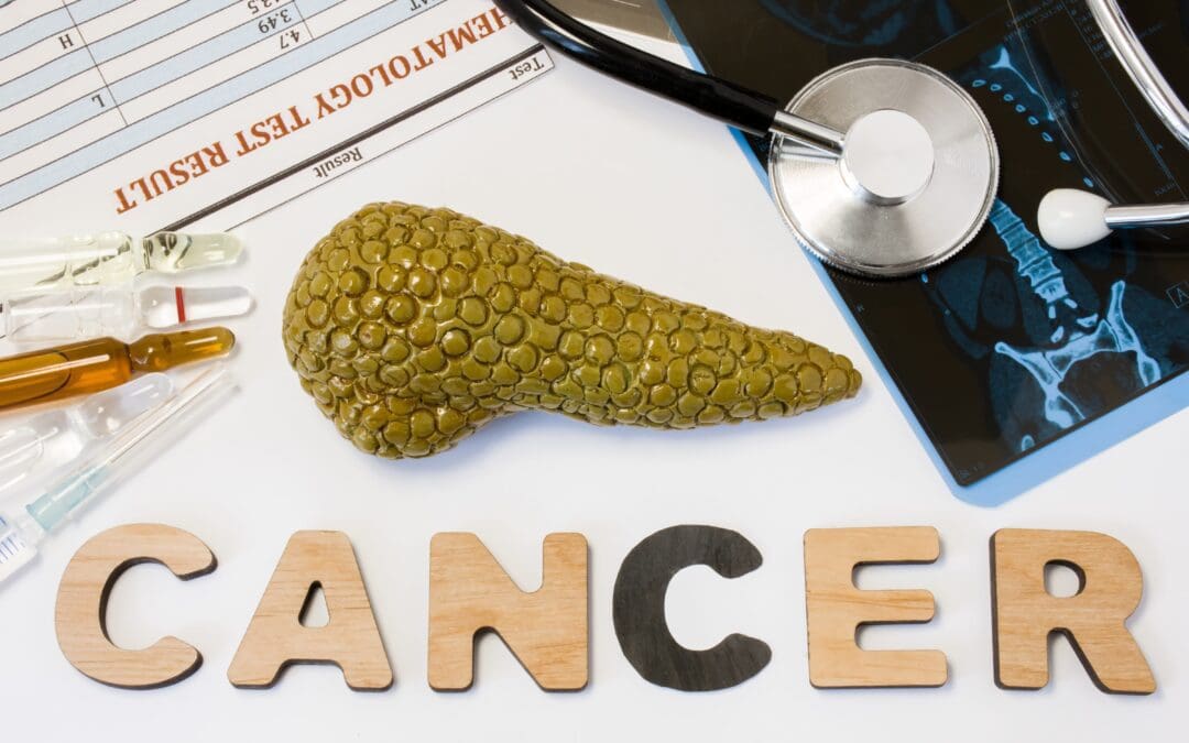 How To Manage Your Diet When You Have Pancreatic Cancer