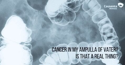 Cancer in my Ampulla of Vater? Sounds like something from Star Wars, not my body. Is that a real thing?