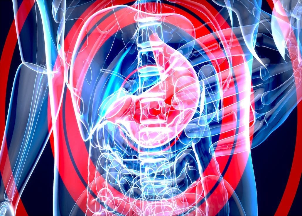 Abstract motion design of the stomach Cancer Types We Treat